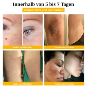 Dermatest-Zertifizierung | Turonu™ Bienengift-Hautcreme