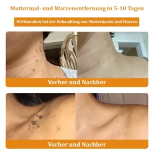 Dermatest-Zertifizierung | Turonu™ Bienengift-Hautcreme