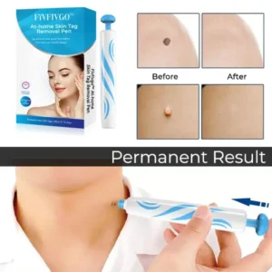 Fivfivgo™ At-Home Skin Tag Removal Pen