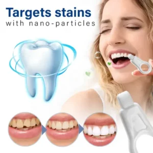 Fivfivgo™ NanoShine Tooth Stain Cleaner