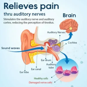 Fivfivgo™ Ohrpflaster zur Tinnitus-Behandlung