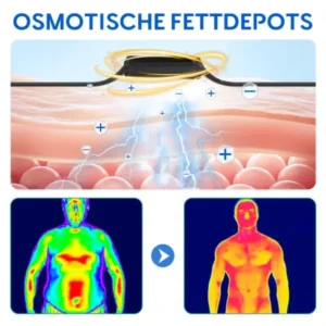 GFOUK™ Ultraschall-Fettverbrennungs- und Entgiftungsarmband