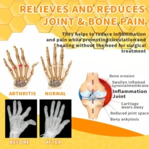 Holiday Sale TAILEDEN™ Bee Venom Joint Therapy Pain Relief Gel