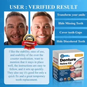 InstantSmile™ Denture Reline Kit