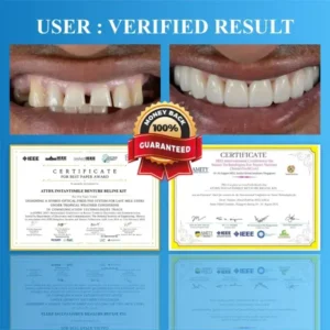 InstantSmile™ Denture Reline Kit