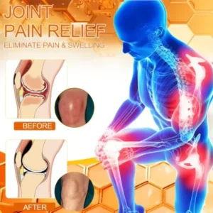 Jorondy™ Bee-Venom Pain-Relief Bone Healing Cream