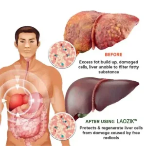 LAOZIK™ Natural Chlorophyll Drops – Powerful Detoxification & Complete Liver Care