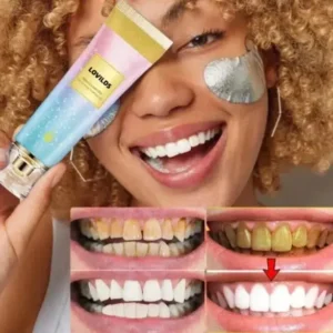 LOVILDS™ Niacinamide Whitening Toothpaste