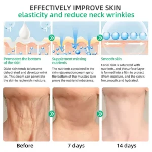 LOVILDS™ Wrinkle Removel Cream