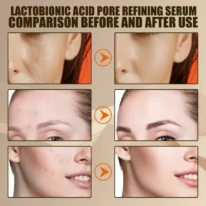 Lactobionic Acid- Pore Contraction Facial Serum 1+1 FREE