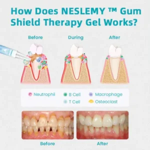 NESLEMY™ Zahnfleischschutz-Therapie-Gel