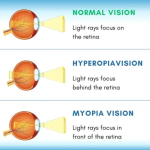 OptiRevive™ Daily Liquid Lens