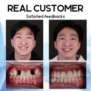 QIAWI – Holiday Smile Upgrade: The Best Dentures for Christmas & New Year!