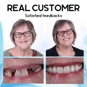 QIAWI – Premium Custom Silicone Denture Set