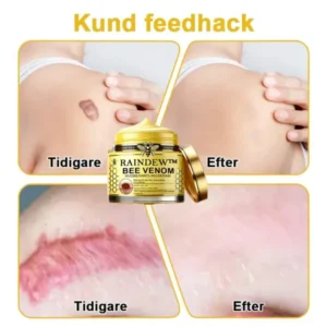 Raindew™ Bee Venom Skin Treatment Cream