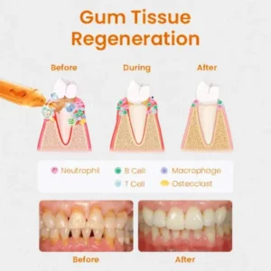 Ring in the New Year with a Smile: QIAWI™ Gum Repair