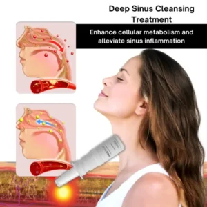 SINUS RELIEF – The Rapid & Permanent Sinus Relief Solution