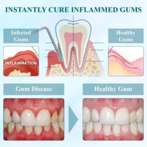 WhiteningSmile™ Coconut Oil GumGuard Mouthwash