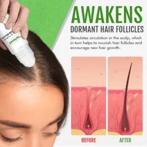 ZeroFall™ Scalp & Hair Roller Booster – Proven and Tested by Dermatologist