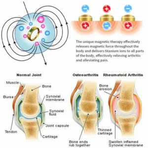 Adjustable opening Lymphatic magnetic therapy ring