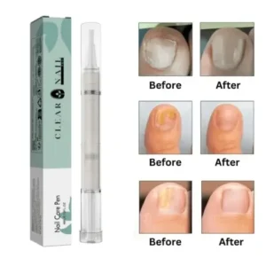 ClearNail Pro™ – Nail Care Pen