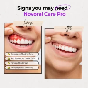 NOVORAL CARE PRO – Complete Oral Care at home