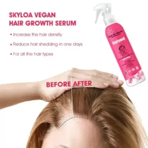 Ourlyard™ Luxe Bee Venom Scalp Treatment HairGrᴏᴡth Hair Spray